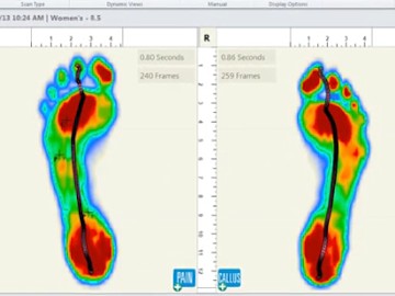 An image of a GaitScan result